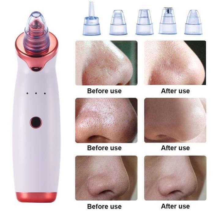 Africa online store Aspirateur de Graisses & Points Noirs Aspirateur de Graisses & Points Noirs