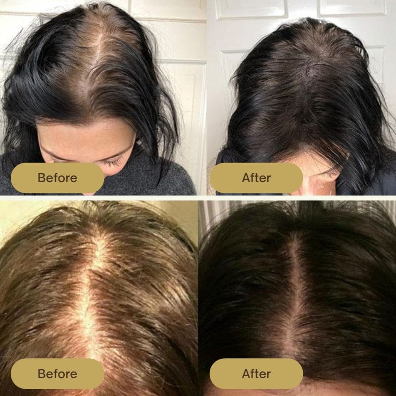 Africa online store 🌿 Huile de Batana – Le secret ancestral pour des cheveux forts et sublimes ! 🌿 Huile de Batana – Le secret ancestral pour des cheveux forts et sublimes !