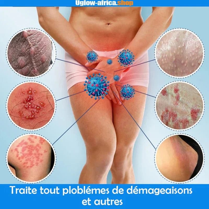 Nouvelle boutique en ligne Crème anti-démangeaisons & Antibactérienne Crème anti-démangeaisons & Antibactérienne