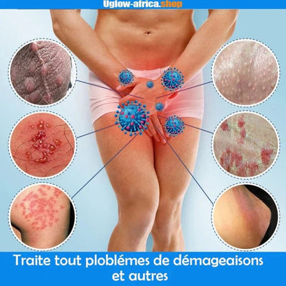Nouvelle boutique en ligne Crème anti-démangeaisons & Antibactérienne Crème anti-démangeaisons & Antibactérienne