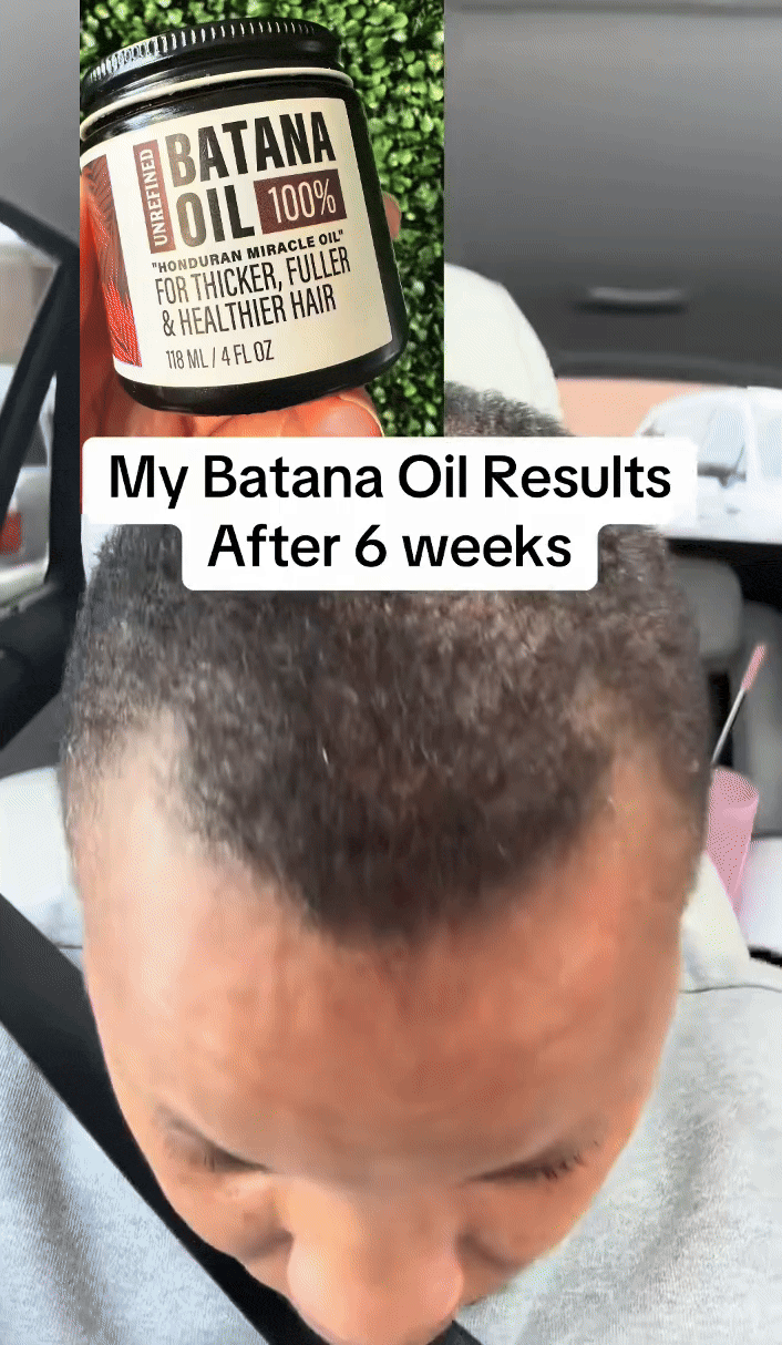 Africa online store 🧔‍♂️🔥 Kit Batana Homme – Anti-Calvitie & Boosteur de Barbe 🧔‍♂️🔥 Kit Batana Homme – Anti-Calvitie & Boosteur de Barbe